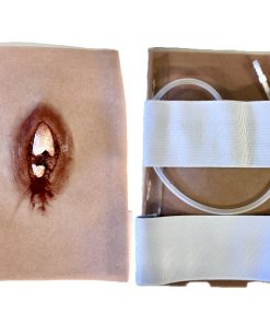 Reisiluun avomurtuma