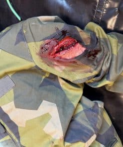 Käsivarren viiltohaava