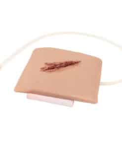 Käsivarren viiltohaava